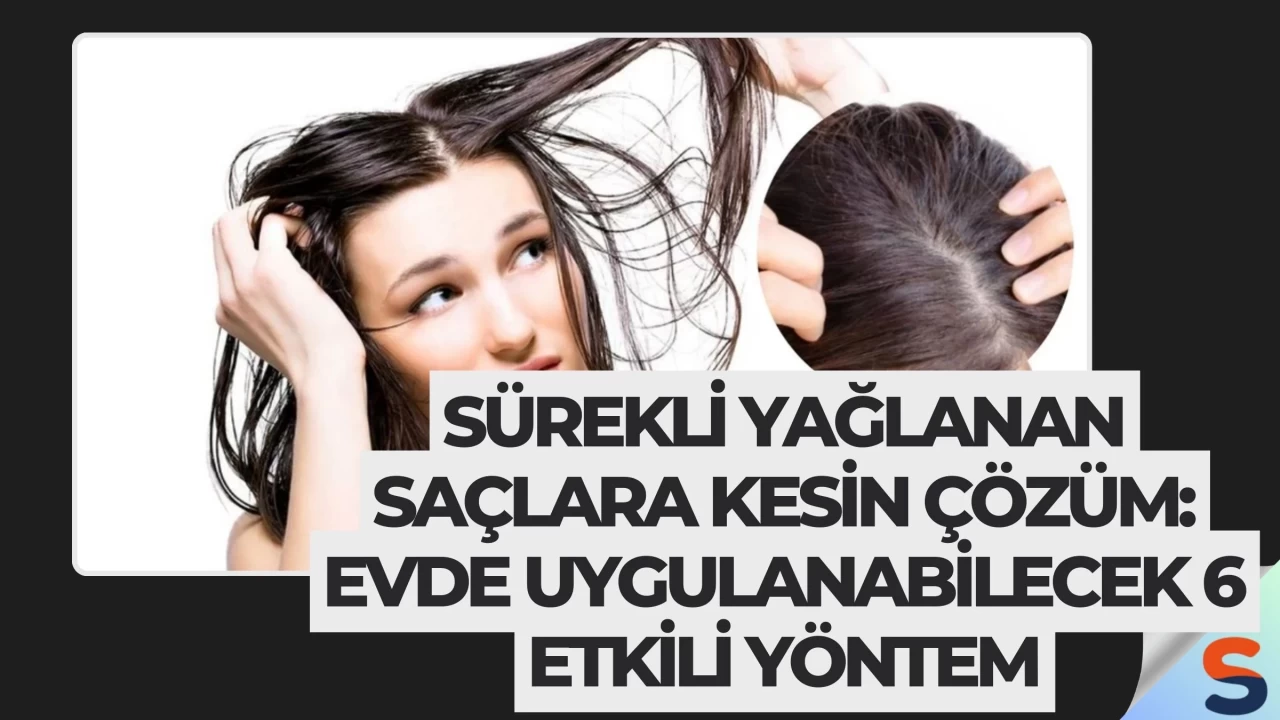 Sürekli Yağlanan Saçlara Kesin Çözüm: Evde Uygulanabilecek 6 Etkili Yöntem