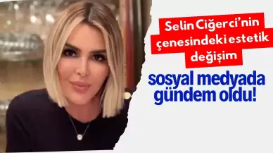 Selin Ciğerci’nin çenesindeki estetik değişim sosyal medyada gündem oldu!