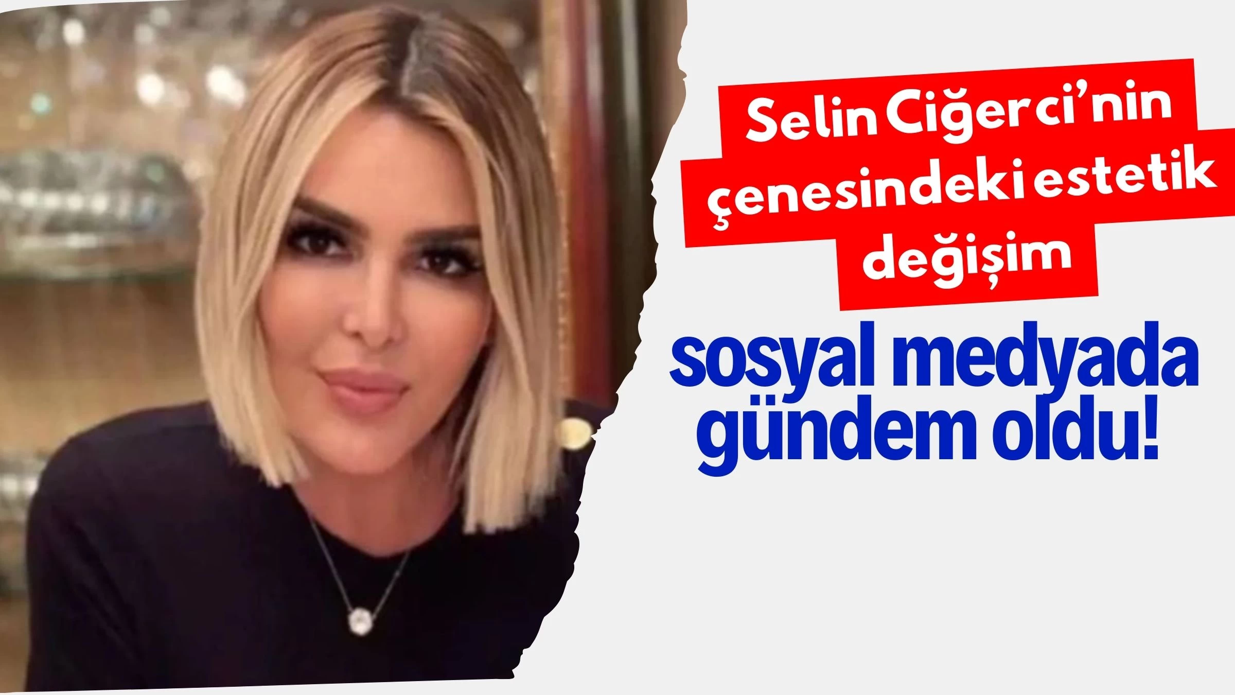 Selin Ciğerci’nin çenesindeki estetik değişim sosyal medyada gündem oldu!
